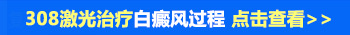 白斑做了四次激光怎么越来越白了呢