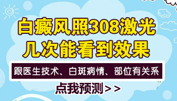 308准分子激光照白癜风几次能见效