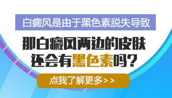 白癜风黑色素完全脱失还能治吗