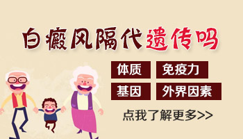 孩子姥爷有白癜风会隔代遗传吗