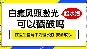 308治疗白癜风打出泡来是好还是不好