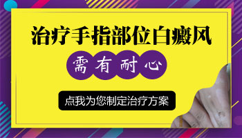 手指缝长白癜风照射308照不好怎么办