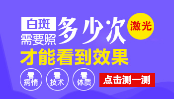 白癜风照射308多少次能好