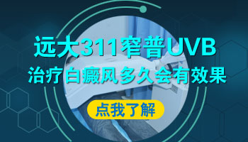 白癜风通过UVB治疗多长时间能痊愈