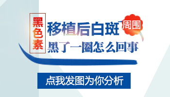 后脑拇指大小白斑做移植需要多少钱