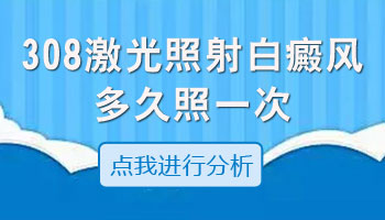 308治疗白癜风间隔时间多久一次