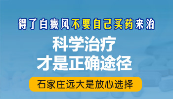 孕期白癜风的治疗药物有哪些