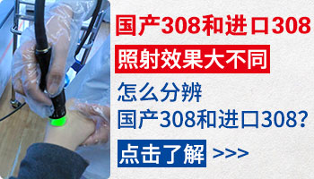 国产308和进口308激光区别 哪个治白癜风好