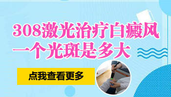 白癜风照激光一个光斑有多大