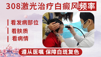 白癜风半个月照一次308激光有效果吗