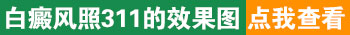 311可以天天照吗 多久才能治好白癜风