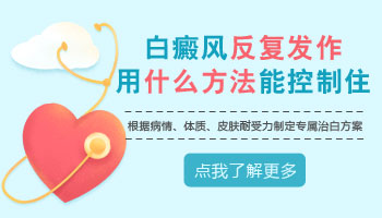 白癜风容易控制吗 白斑怎么控制
