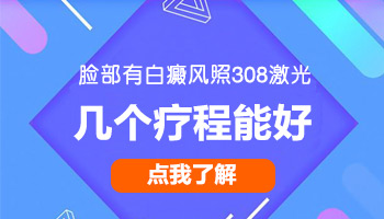 脸部白癜风照308有没有作用