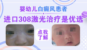 婴幼儿白癜风可以照308准分子激光吗