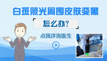 白癜风照光治疗会使正常皮肤发黑