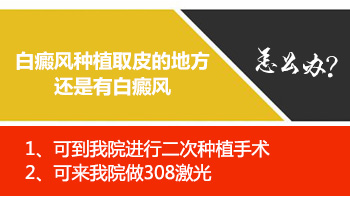 白癜风做植皮手术取皮好几次还有点白