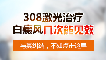 308治疗白癜风每周两次和一次哪个好