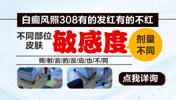 治疗白癜风医院用的308准分子激光能量是多少的