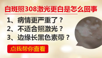 308准分子激光治疗白癜风后白斑更白了