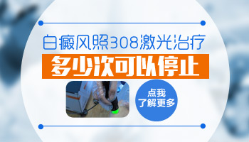 白癜风308照多少次可以停 多少钱