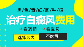 白斑种植黑色素的费用高吗