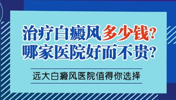 308激光治疗白癜风要多少钱