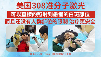 乳房周围长白癜风可以用308光疗仪照射吗