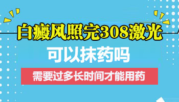 308治疗白癜风完事后可以抹药吗