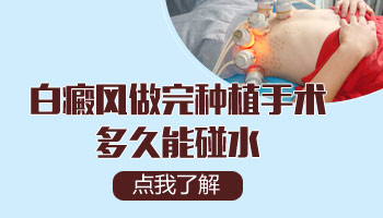 白癜风做了移植手术多久能碰水