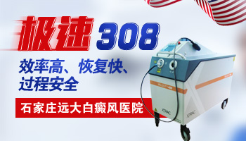 国产308激光机器图 国产光疗照白癜风效果