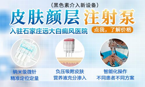 纳米促黑治疗白癜风多久做一次