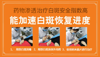 纳米促黑治疗白癜风多久做一次