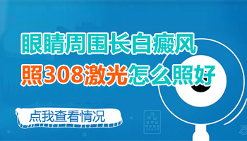 眼睛部位的白癜风可以照光吗