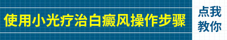 希格玛家用白癜风光疗机贵不贵 效果怎么样