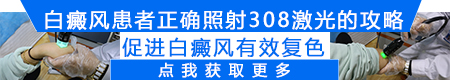 白癜风发现一个月了怎么治