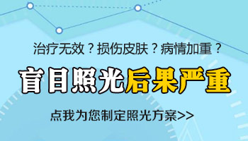 白癜风光疗没效果要不要换治疗方法