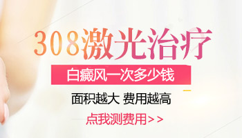 308激光治疗一次多少钱 白癜风的治疗费用