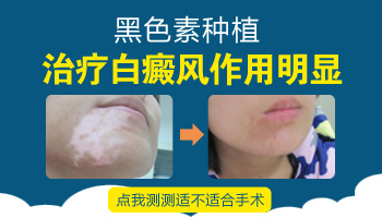 白癜风黑色素种植手术夏季做合适吗