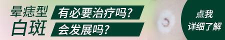 晕痣型白癜风可以治愈吗