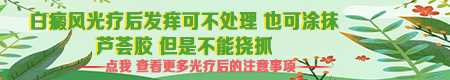 308准分子激光治疗白斑有副作用吗