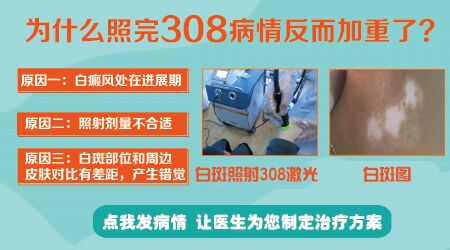 为什么照308反倒白斑加重