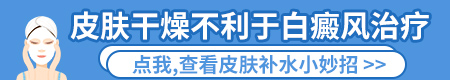 白癜风该如何治疗 治疗方法有哪些