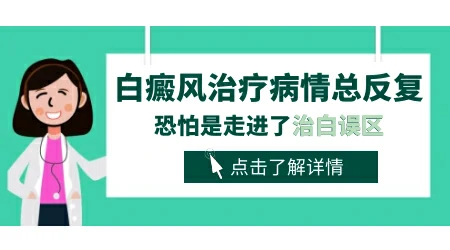 吃药结合抹药治疗白癜风可以吗