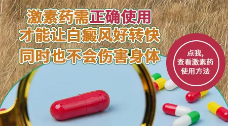 治疗白癜风可以用激素药吗