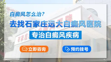 白癜风在伍德灯下是浅白色好治疗吗