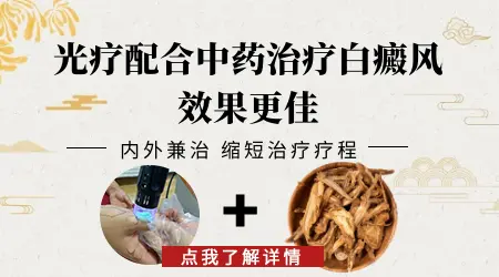 白癜风早期吃中药能控制住吗