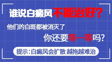 白癜风能治好吗 身上好几处白癜风