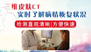 隐形白斑可以照光吗