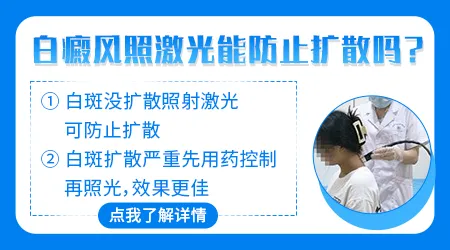 激光308一般照白斑要多少钱