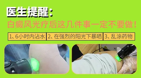 绿豆大小的白斑需要照多久308激光